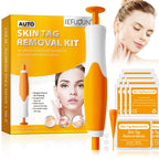 Rubber Rings Face Mole Removal Tool Kits Safety Painless Remove Skin Wart Kits Face Beauty Accessories for Neck Chin Back