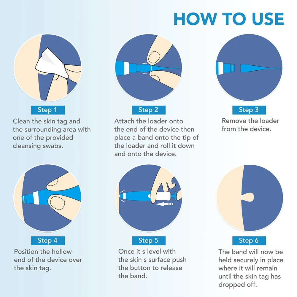 Rubber Rings Face Mole Removal Tool Kits Safety Painless Remove Skin Wart Kits Face Beauty Accessories for Neck Chin Back